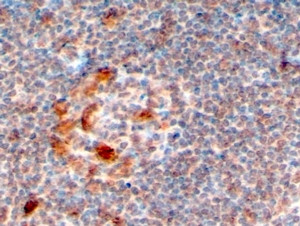 ZCCHC11 Antibody in Immunohistochemistry (Paraffin) (IHC (P))