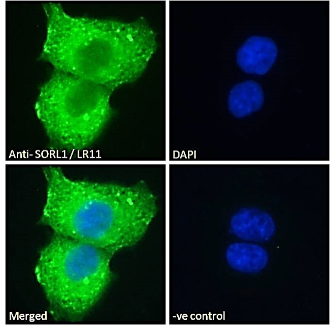 SORL1 Antibody in Immunocytochemistry (ICC/IF)