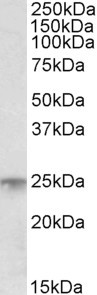 MSC Antibody in Western Blot (WB)