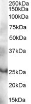 GRAP Antibody in Western Blot (WB)