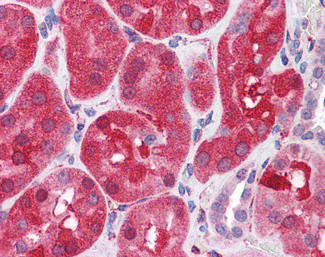 SHP2 Antibody in Immunohistochemistry (Paraffin) (IHC (P))