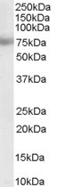 MTA1 Antibody in Western Blot (WB)