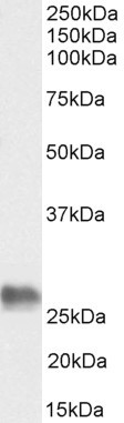 BAG2 Antibody in Western Blot (WB)