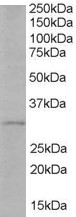 TIRAP Antibody in Western Blot (WB)