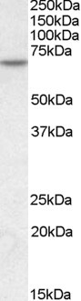 MTM1 Antibody in Western Blot (WB)