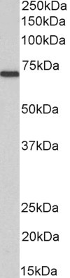 MTM1 Antibody in Western Blot (WB)