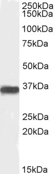 PP2A alpha/beta Antibody in Western Blot (WB)