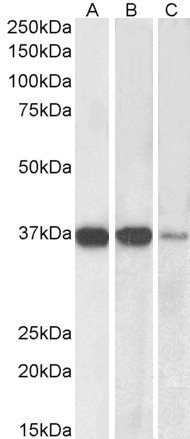 PP2A alpha/beta Antibody in Western Blot (WB)