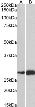 ATF5 Antibody in Western Blot (WB)