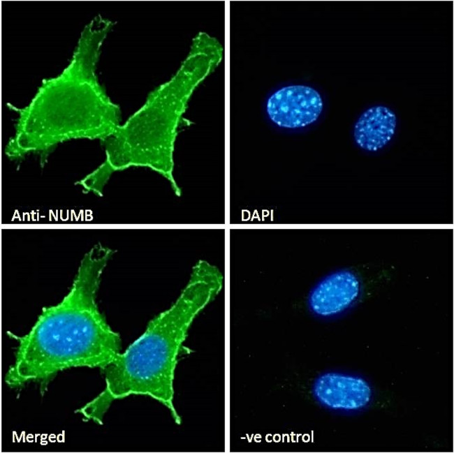 NUMB Antibody in Immunocytochemistry (ICC/IF)