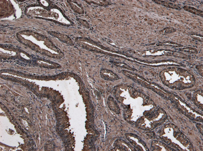 NUMB Antibody in Immunohistochemistry (Paraffin) (IHC (P))