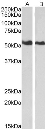 Annexin A11 Antibody in Western Blot (WB)