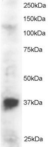 PINX1 Antibody in Western Blot (WB)