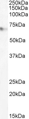 MARK4 Antibody in Western Blot (WB)