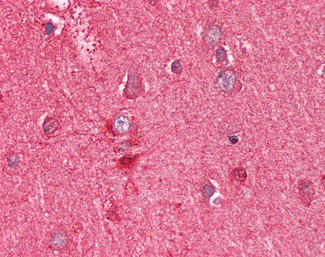 PEBP1 Antibody in Immunohistochemistry (Paraffin) (IHC (P))