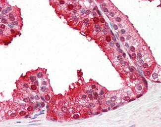 PEBP1 Antibody in Immunohistochemistry (Paraffin) (IHC (P))