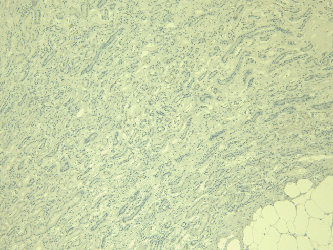 IRF6 Antibody in Immunohistochemistry (Paraffin) (IHC (P))