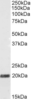 STMN2 Antibody in Western Blot (WB)