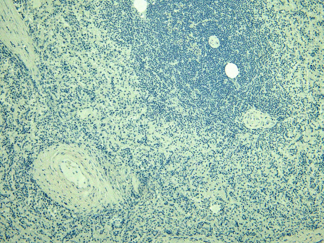 IBA1 Antibody in Immunohistochemistry (Paraffin) (IHC (P))