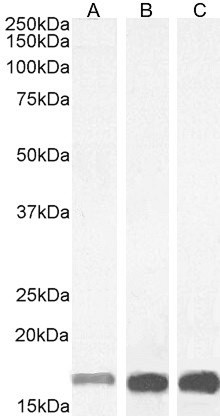 IBA1 Antibody in Western Blot (WB)