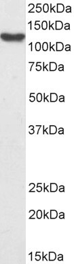 HLTF Antibody in Western Blot (WB)