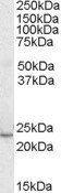 KLF16 Antibody in Western Blot (WB)