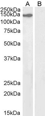 KIF4A Antibody in Western Blot (WB)