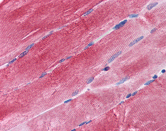 BAG3 Antibody in Immunohistochemistry (Paraffin) (IHC (P))