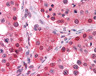 TrxR1 Antibody in Immunohistochemistry (Paraffin) (IHC (P))