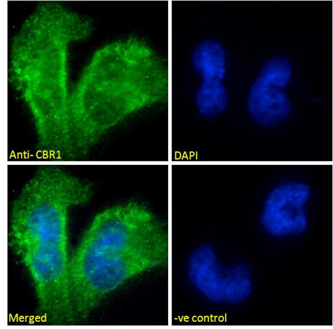 CBR1 Antibody in Immunocytochemistry (ICC/IF)