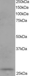 DCXR Antibody in Western Blot (WB)