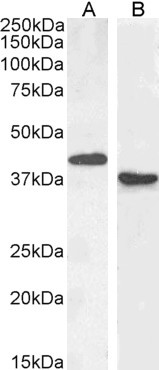 PAX5 Antibody in Western Blot (WB)