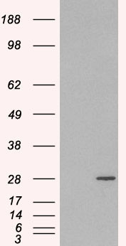 RAB11A Antibody in Western Blot (WB)