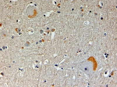 NOS1AP Antibody in Immunohistochemistry (Paraffin) (IHC (P))