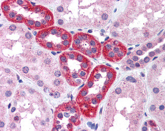 p70 S6 Kinase Antibody in Immunohistochemistry (Paraffin) (IHC (P))