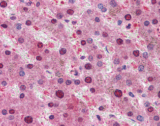 p70 S6 Kinase Antibody in Immunohistochemistry (Paraffin) (IHC (P))