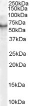 p70 S6 Kinase Antibody in Western Blot (WB)