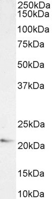 JWA Antibody in Western Blot (WB)