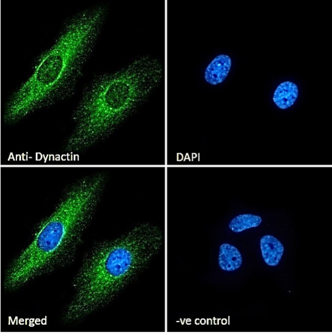 Dynactin 1 Antibody in Immunocytochemistry (ICC/IF)