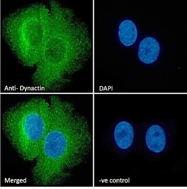 Dynactin 1 Antibody in Immunocytochemistry (ICC/IF)