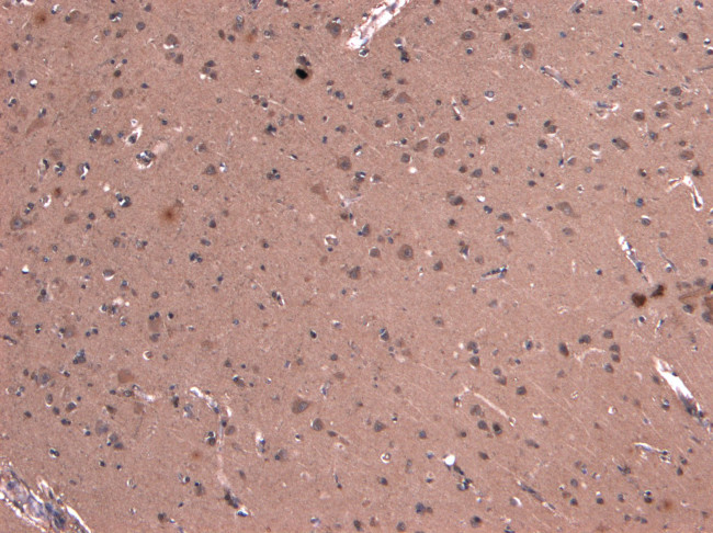 Dynactin 1 Antibody in Immunohistochemistry (Paraffin) (IHC (P))