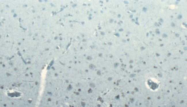 Dynactin 1 Antibody in Immunohistochemistry (Paraffin) (IHC (P))