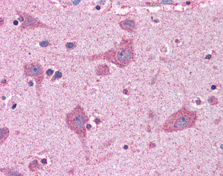 ACSL4 Antibody in Immunohistochemistry (Paraffin) (IHC (P))