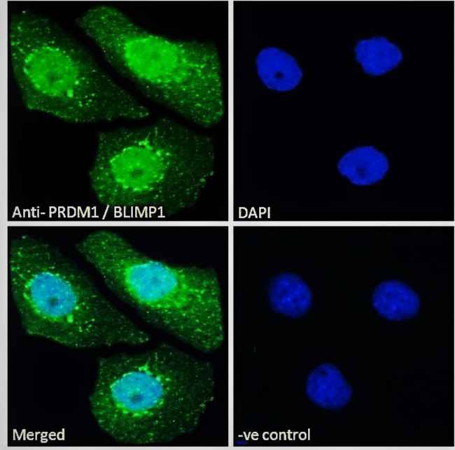 Blimp-1 Antibody in Immunocytochemistry (ICC/IF)