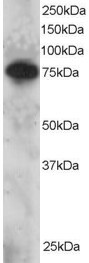 SETMAR Antibody in Western Blot (WB)