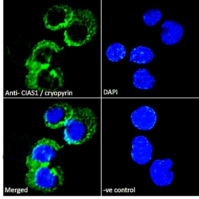 NLRP3 Antibody in Immunocytochemistry (ICC/IF)