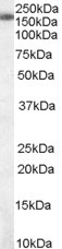 SART3 Antibody in Western Blot (WB)