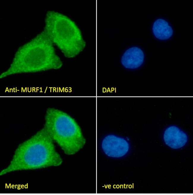 MURF1 Antibody in Immunocytochemistry (ICC/IF)