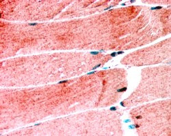 MURF1 Antibody in Immunohistochemistry (Paraffin) (IHC (P))