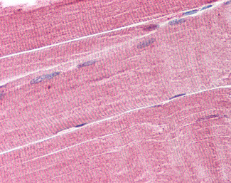 MURF1 Antibody in Immunohistochemistry (Paraffin) (IHC (P))